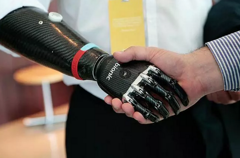 上肢截肢后安裝河南假肢注意的事項(圖1) 上肢截肢后安裝河南假肢注意的事項(圖1)