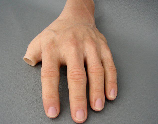 手指假肢價(jià)格安裝假肢需要花費(fèi)多少錢(圖1) 手指假肢價(jià)格安裝假肢需要花費(fèi)多少錢(圖1)