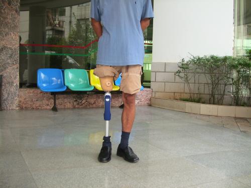 鄭州假肢廠家假肢價格是多少呢(圖1) 鄭州假肢廠家假肢價格是多少呢(圖1)