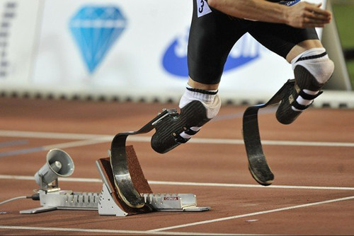 患者安裝臨時假肢和長期性假肢區(qū)別在哪(圖1) 患者安裝臨時假肢和長期性假肢區(qū)別在哪(圖1)